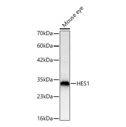 Western Blot - Anti-HES1 Antibody (A81081) - Antibodies.com