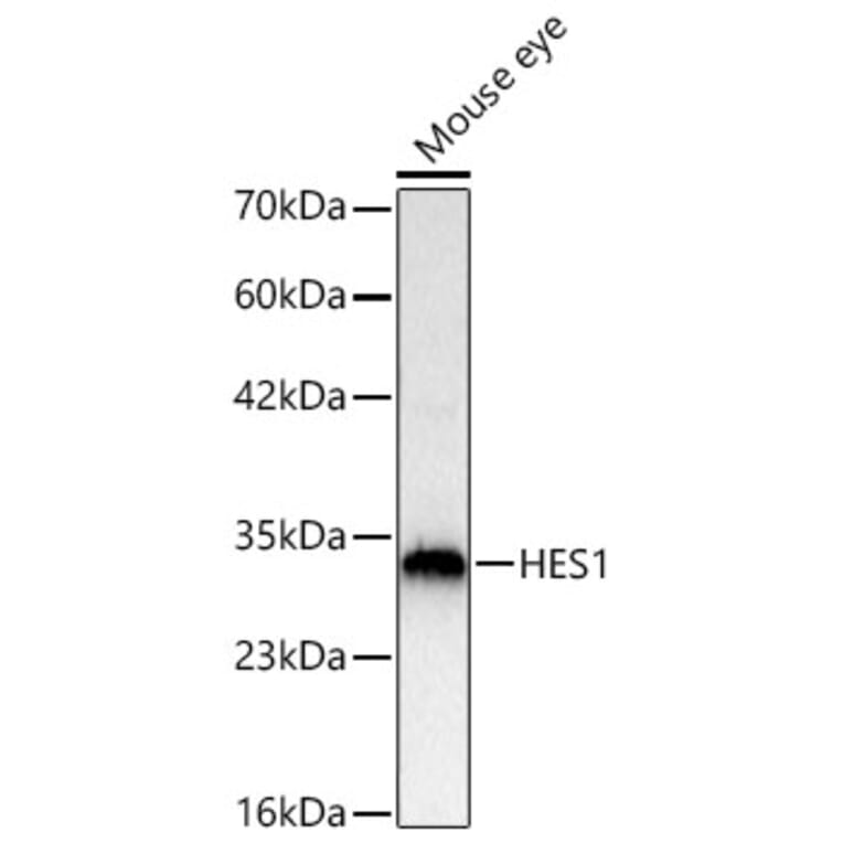 Western Blot - Anti-HES1 Antibody (A81081) - Antibodies.com