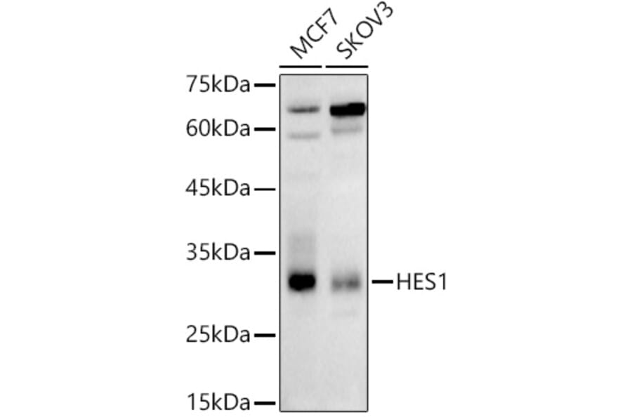 Western Blot - Anti-Hes1 Antibody (A81082) - Antibodies.com