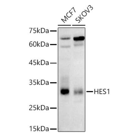 Western Blot - Anti-Hes1 Antibody (A81082) - Antibodies.com