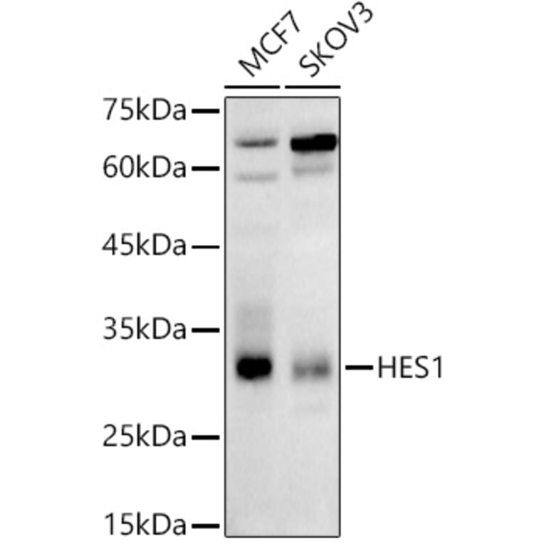 Western Blot - Anti-Hes1 Antibody (A81082) - Antibodies.com