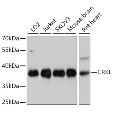 Western Blot - Anti-CrkL Antibody (A81083) - Antibodies.com