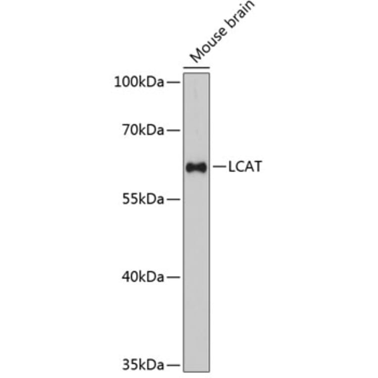 Western Blot - Anti-LCAT Antibody (A81085) - Antibodies.com