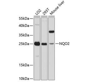 Western Blot - Anti-NQO2 Antibody (A81086) - Antibodies.com