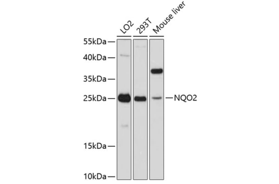 Western Blot - Anti-NQO2 Antibody (A81086) - Antibodies.com