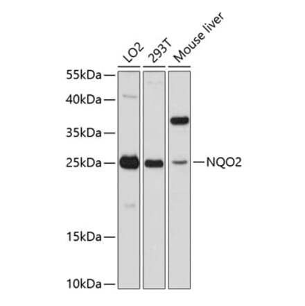 Western Blot - Anti-NQO2 Antibody (A81086) - Antibodies.com