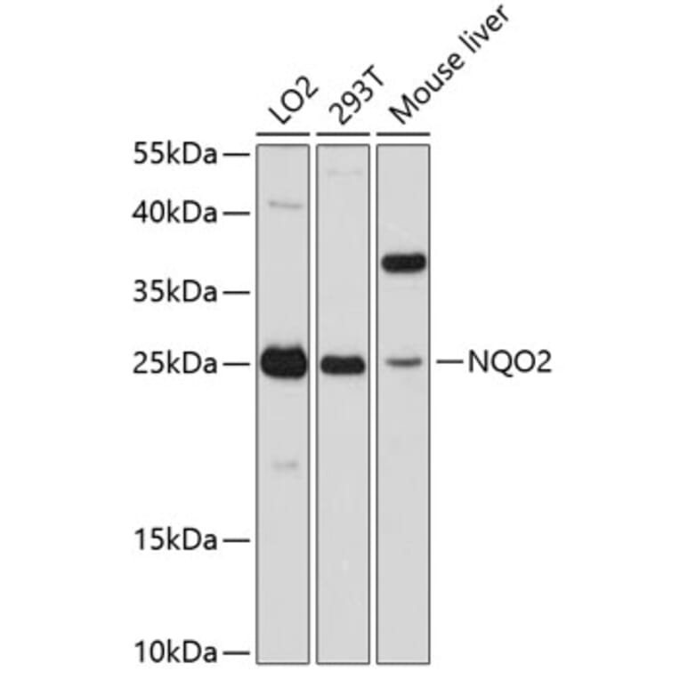 Western Blot - Anti-NQO2 Antibody (A81086) - Antibodies.com