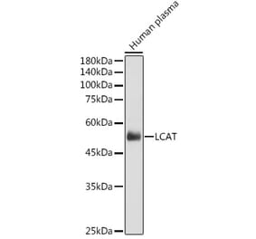Western Blot - Anti-LCAT Antibody (A81087) - Antibodies.com