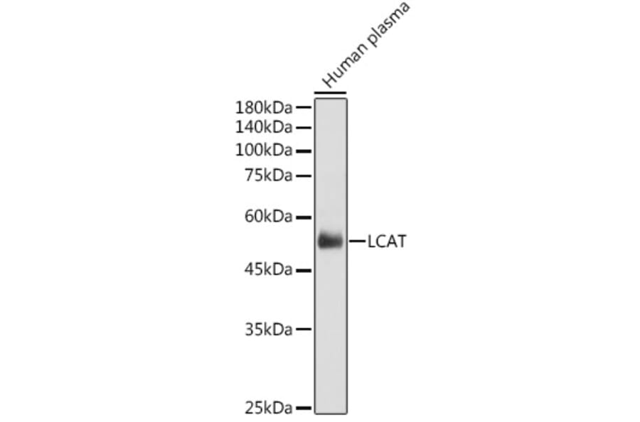 Western Blot - Anti-LCAT Antibody (A81087) - Antibodies.com