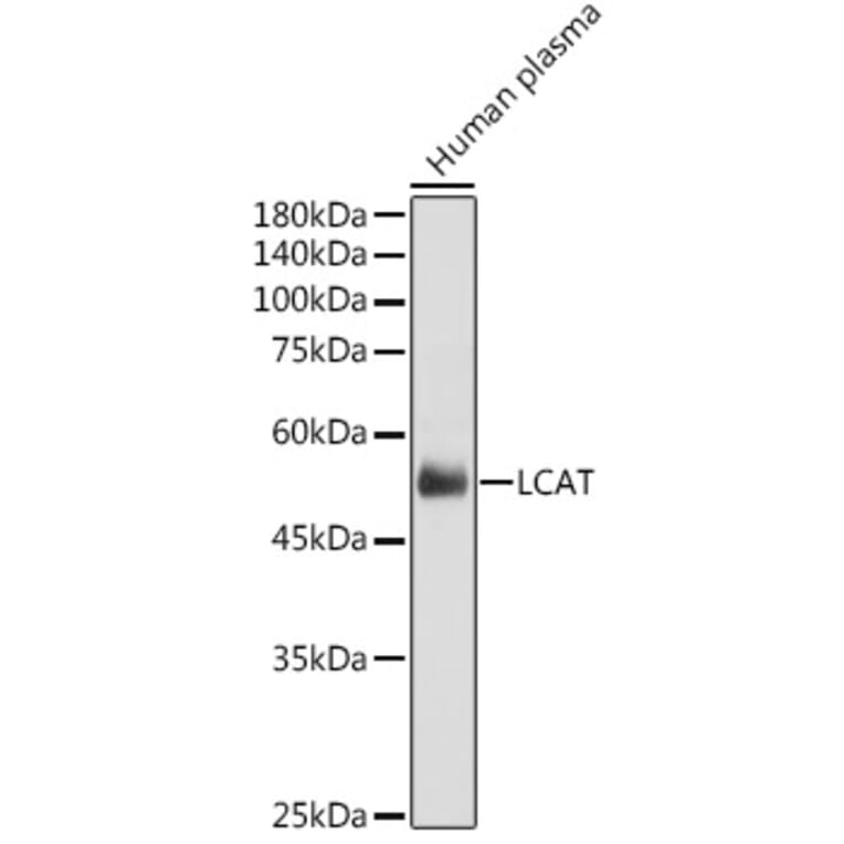 Western Blot - Anti-LCAT Antibody (A81087) - Antibodies.com