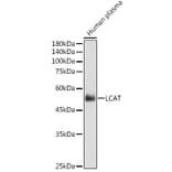 Western Blot - Anti-LCAT Antibody (A81087) - Antibodies.com