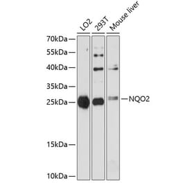 Western Blot - Anti-NQO2 Antibody (A81088) - Antibodies.com