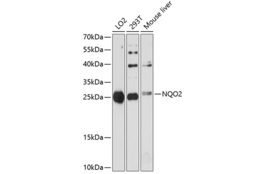 Western Blot - Anti-NQO2 Antibody (A81088) - Antibodies.com