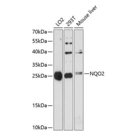 Western Blot - Anti-NQO2 Antibody (A81088) - Antibodies.com