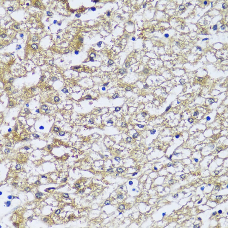 Immunohistochemistry - Anti-NQO2 Antibody (A81088) - Antibodies.com
