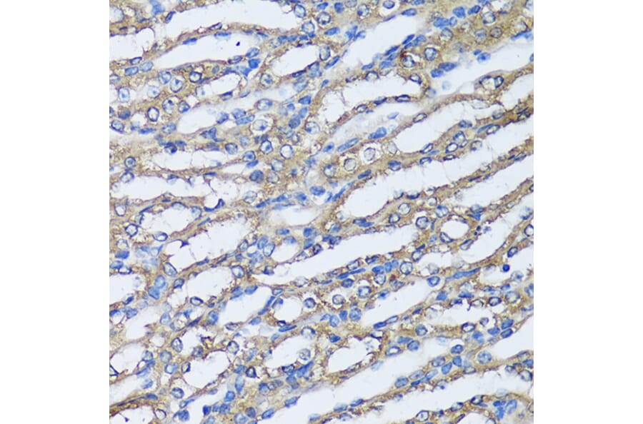 Immunohistochemistry - Anti-NQO2 Antibody (A81088) - Antibodies.com