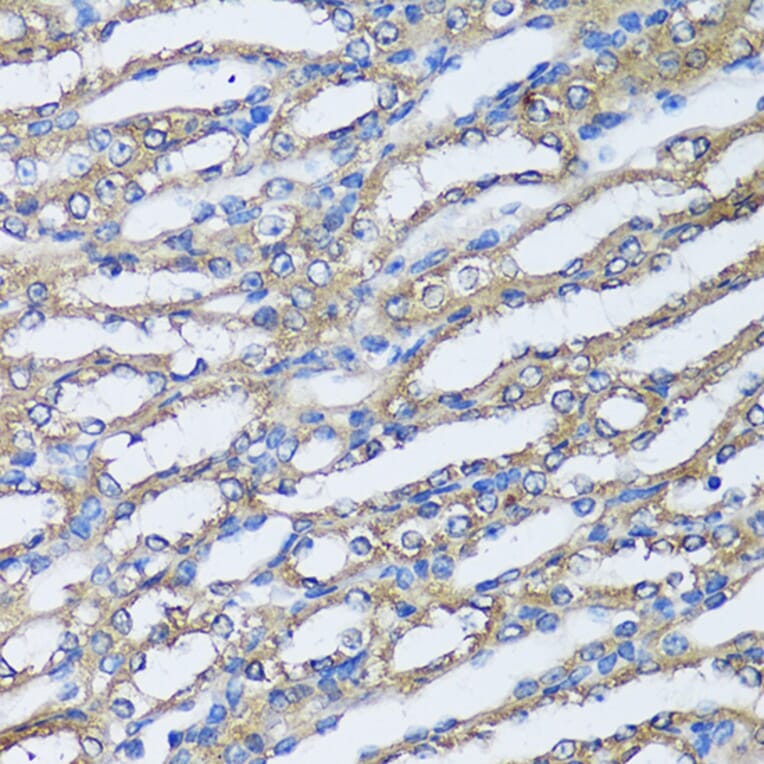 Immunohistochemistry - Anti-NQO2 Antibody (A81088) - Antibodies.com