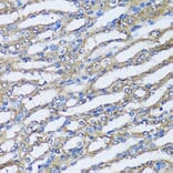 Immunohistochemistry - Anti-NQO2 Antibody (A81088) - Antibodies.com