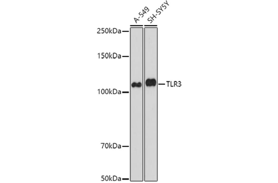 Western Blot - Anti-TLR3 Antibody (A81091) - Antibodies.com