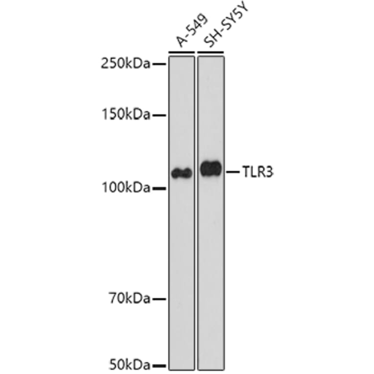 Western Blot - Anti-TLR3 Antibody (A81091) - Antibodies.com