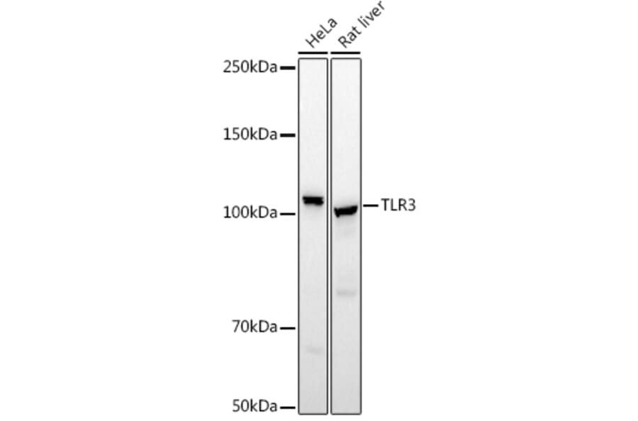 Western Blot - Anti-TLR3 Antibody (A81091) - Antibodies.com
