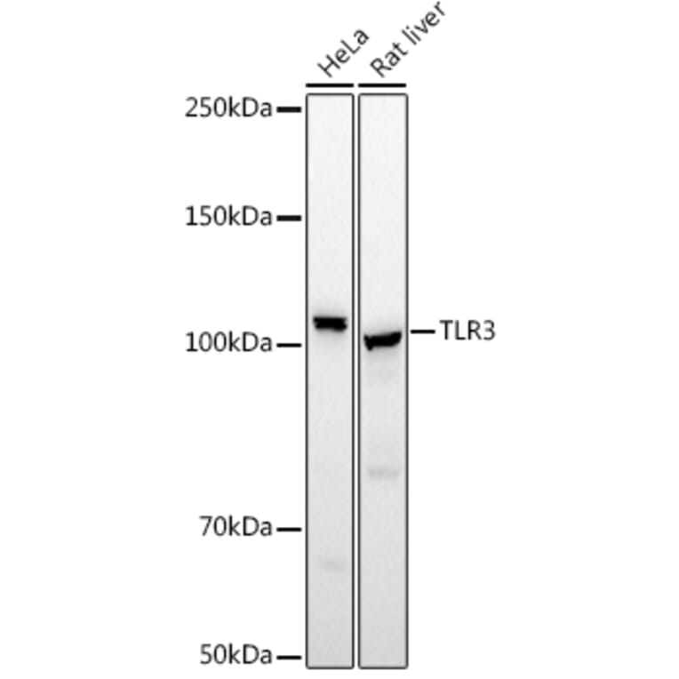 Western Blot - Anti-TLR3 Antibody (A81091) - Antibodies.com