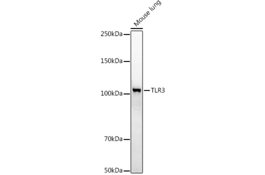 Western Blot - Anti-TLR3 Antibody (A81091) - Antibodies.com