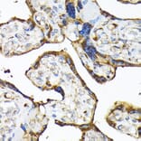 Immunohistochemistry - Anti-TLR3 Antibody (A81091) - Antibodies.com