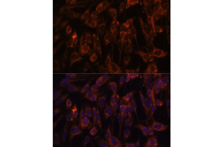 Immunofluorescence - Anti-TLR3 Antibody (A81091) - Antibodies.com