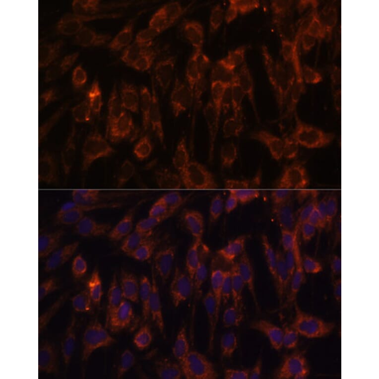 Immunofluorescence - Anti-TLR3 Antibody (A81091) - Antibodies.com