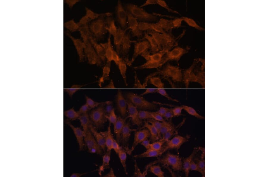 Immunofluorescence - Anti-TLR3 Antibody (A81091) - Antibodies.com
