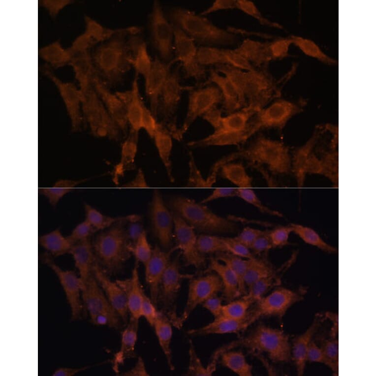 Immunofluorescence - Anti-TLR3 Antibody (A81091) - Antibodies.com
