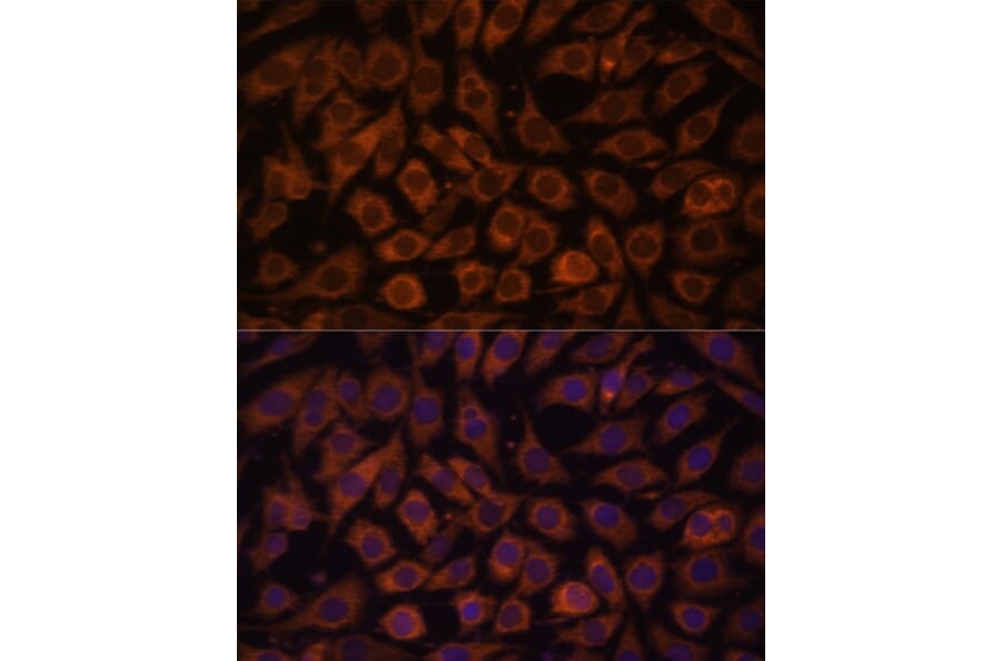 Immunofluorescence - Anti-TLR3 Antibody (A81091) - Antibodies.com
