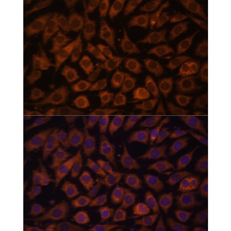 Immunofluorescence - Anti-TLR3 Antibody (A81091) - Antibodies.com