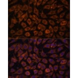Immunofluorescence - Anti-TLR3 Antibody (A81091) - Antibodies.com