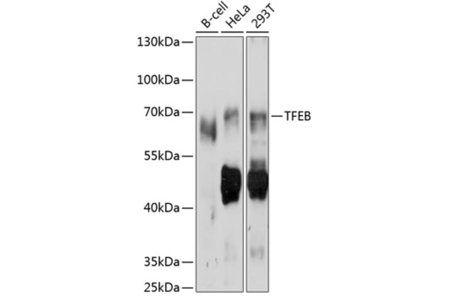 Western Blot - Anti-TFEB Antibody (A11796) - Antibodies.com