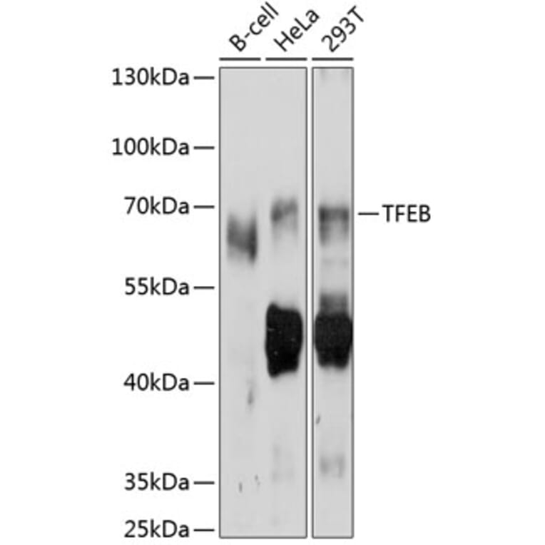 Western Blot - Anti-TFEB Antibody (A11796) - Antibodies.com