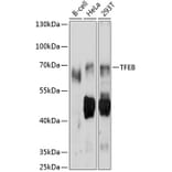 Western Blot - Anti-TFEB Antibody (A11796) - Antibodies.com
