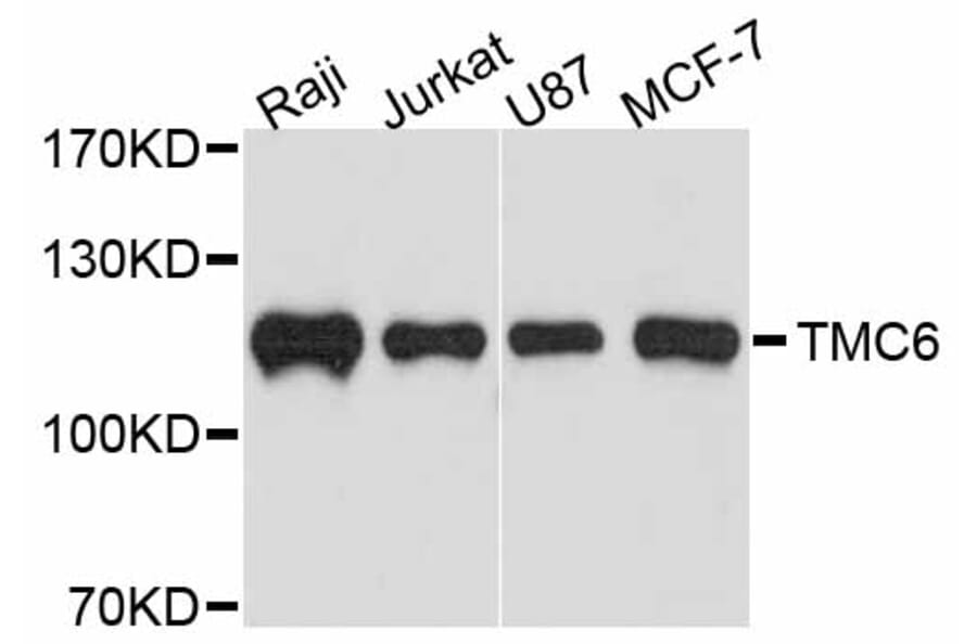 Western Blot - Anti-TMC6 Antibody (A11807) - Antibodies.com