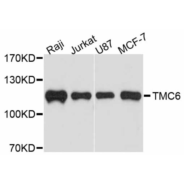 Western Blot - Anti-TMC6 Antibody (A11807) - Antibodies.com