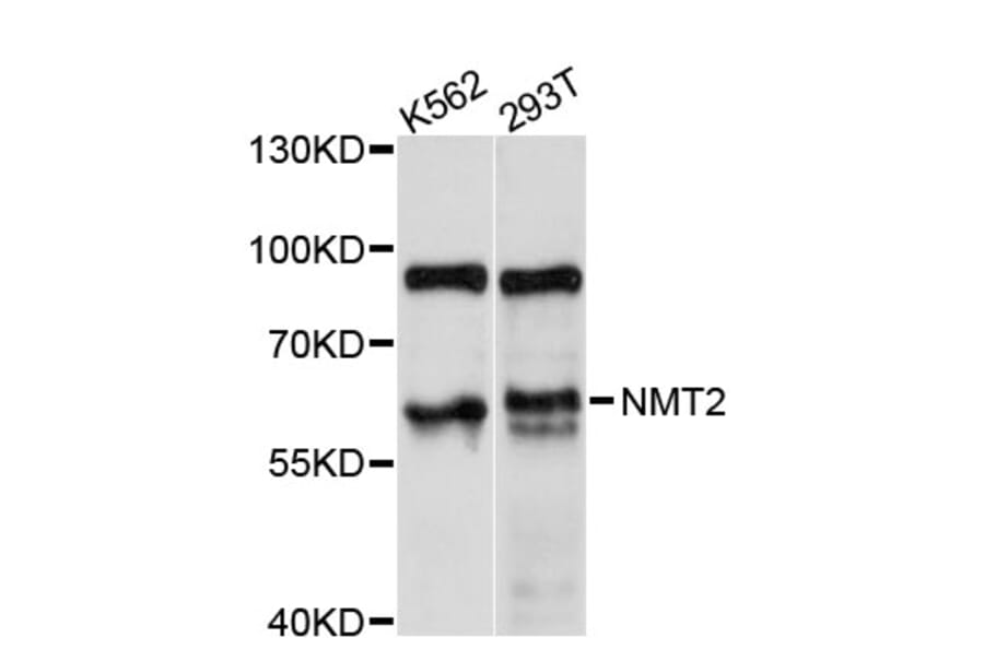 Western Blot - Anti-NMT2 Antibody (A11808) - Antibodies.com