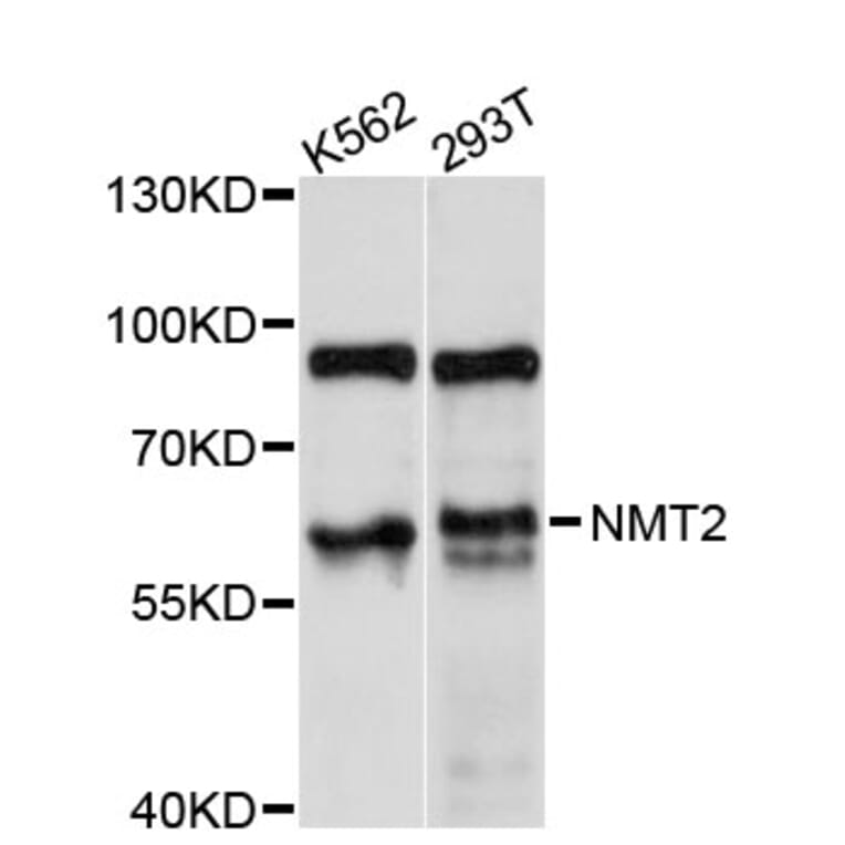Western Blot - Anti-NMT2 Antibody (A11808) - Antibodies.com