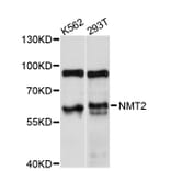 Western Blot - Anti-NMT2 Antibody (A11808) - Antibodies.com