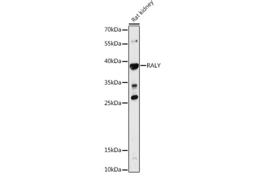 Western Blot - Anti-RALY Antibody (A81095) - Antibodies.com