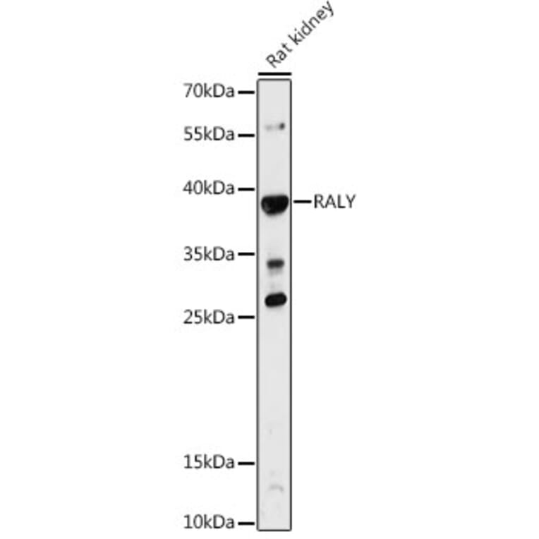 Western Blot - Anti-RALY Antibody (A81095) - Antibodies.com