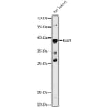 Western Blot - Anti-RALY Antibody (A81095) - Antibodies.com