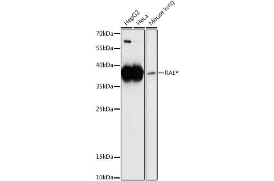 Western Blot - Anti-RALY Antibody (A81095) - Antibodies.com