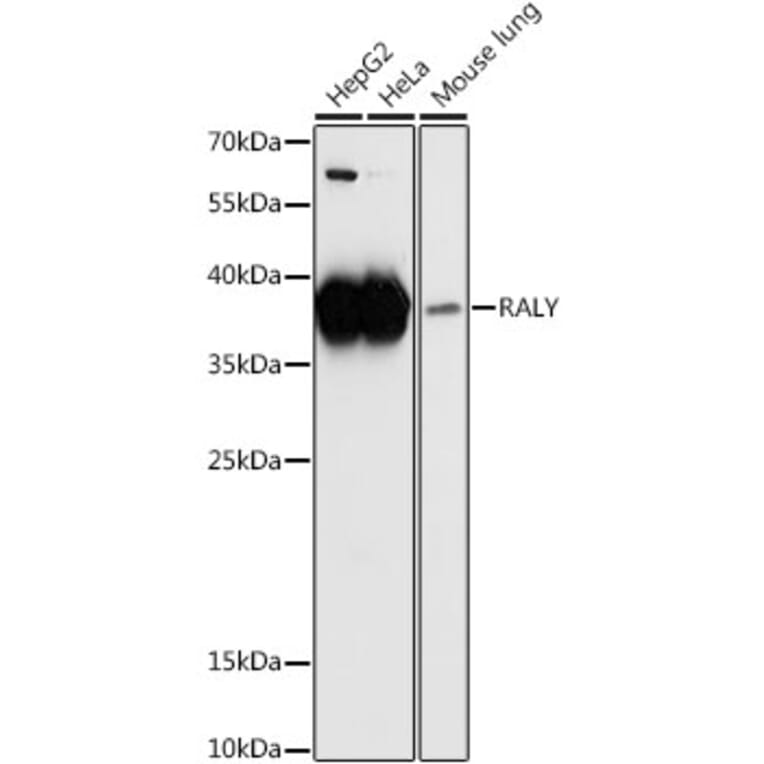 Western Blot - Anti-RALY Antibody (A81095) - Antibodies.com