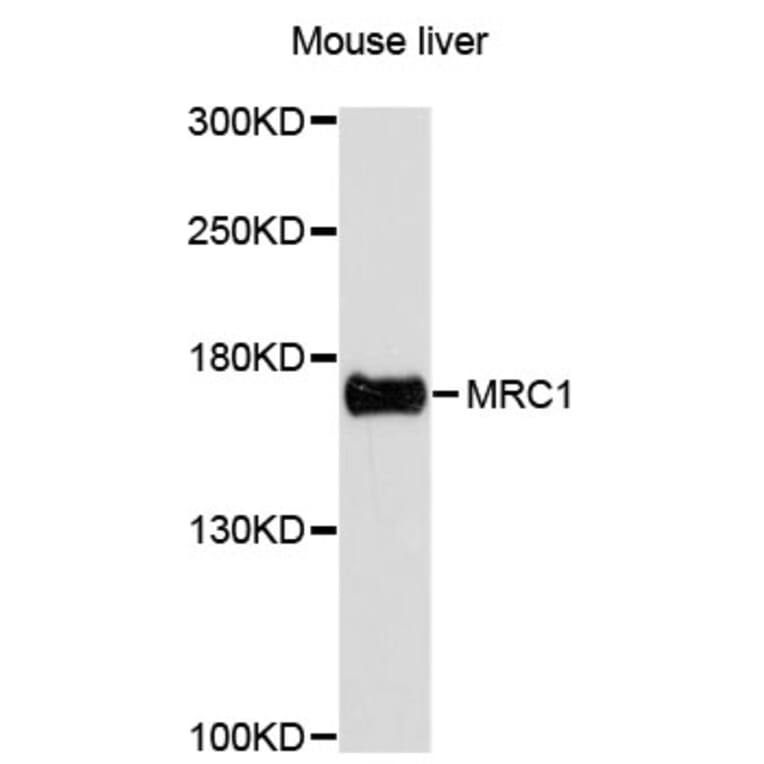Western Blot - Anti-MRC1 Antibody (A11816) - Antibodies.com