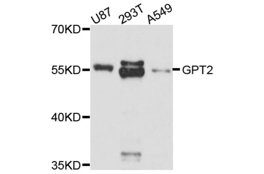 Western Blot - Anti-GPT2 Antibody (A11819) - Antibodies.com